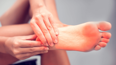 How to Use Cbd Oil for Plantar Fasciitis