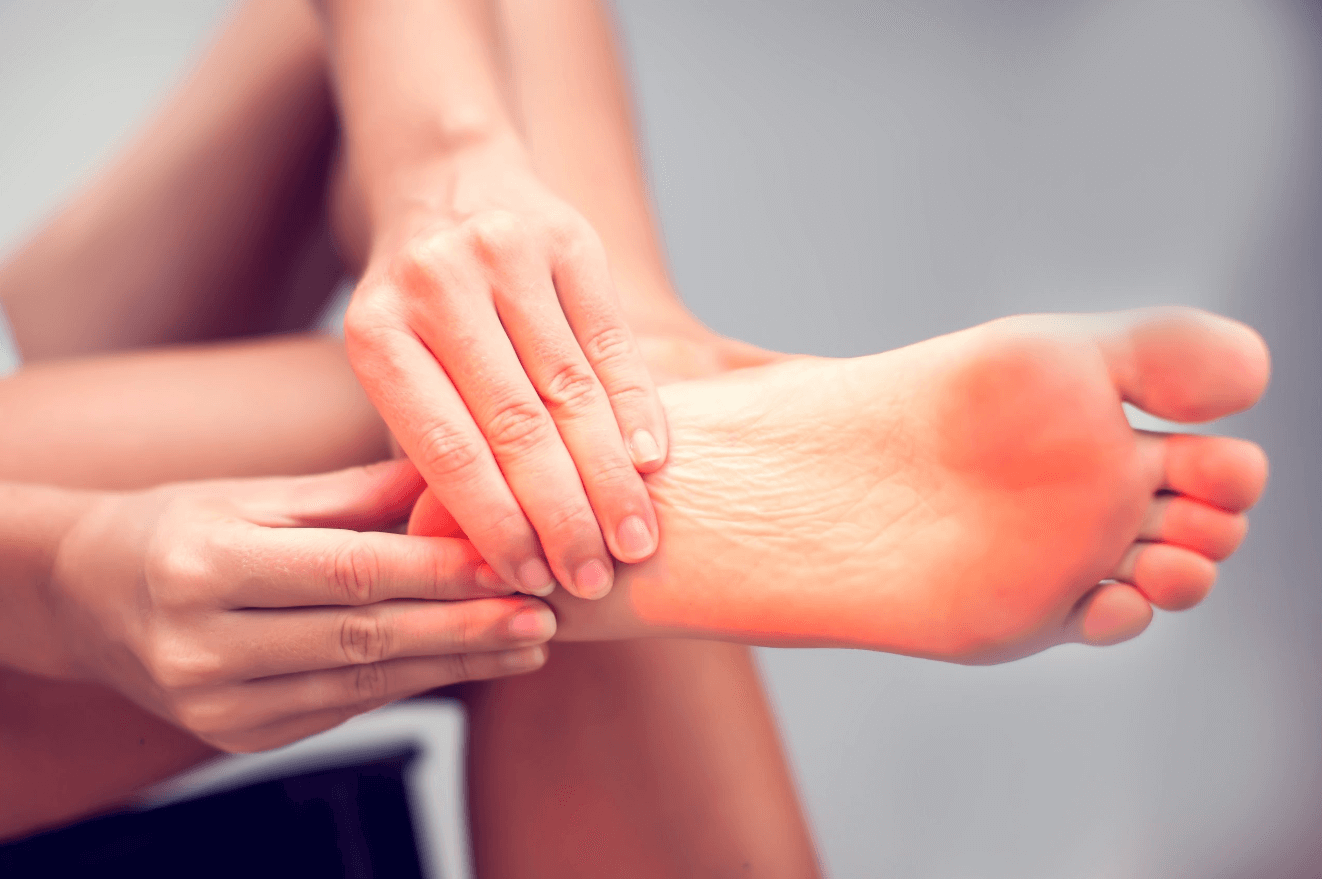 How to Use Cbd Oil for Plantar Fasciitis